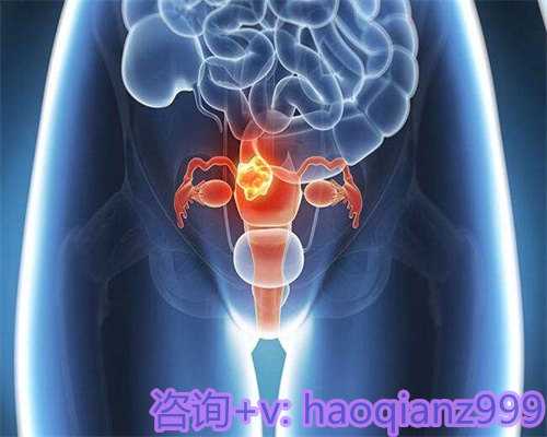 广州供卵代生包男孩,广东生育率与出生率低迷：不孕不育患者的希望与对策