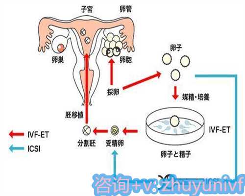 携手共筑生命希望，全国不孕不育、卵巢早衰、高龄产妇火热报名中！