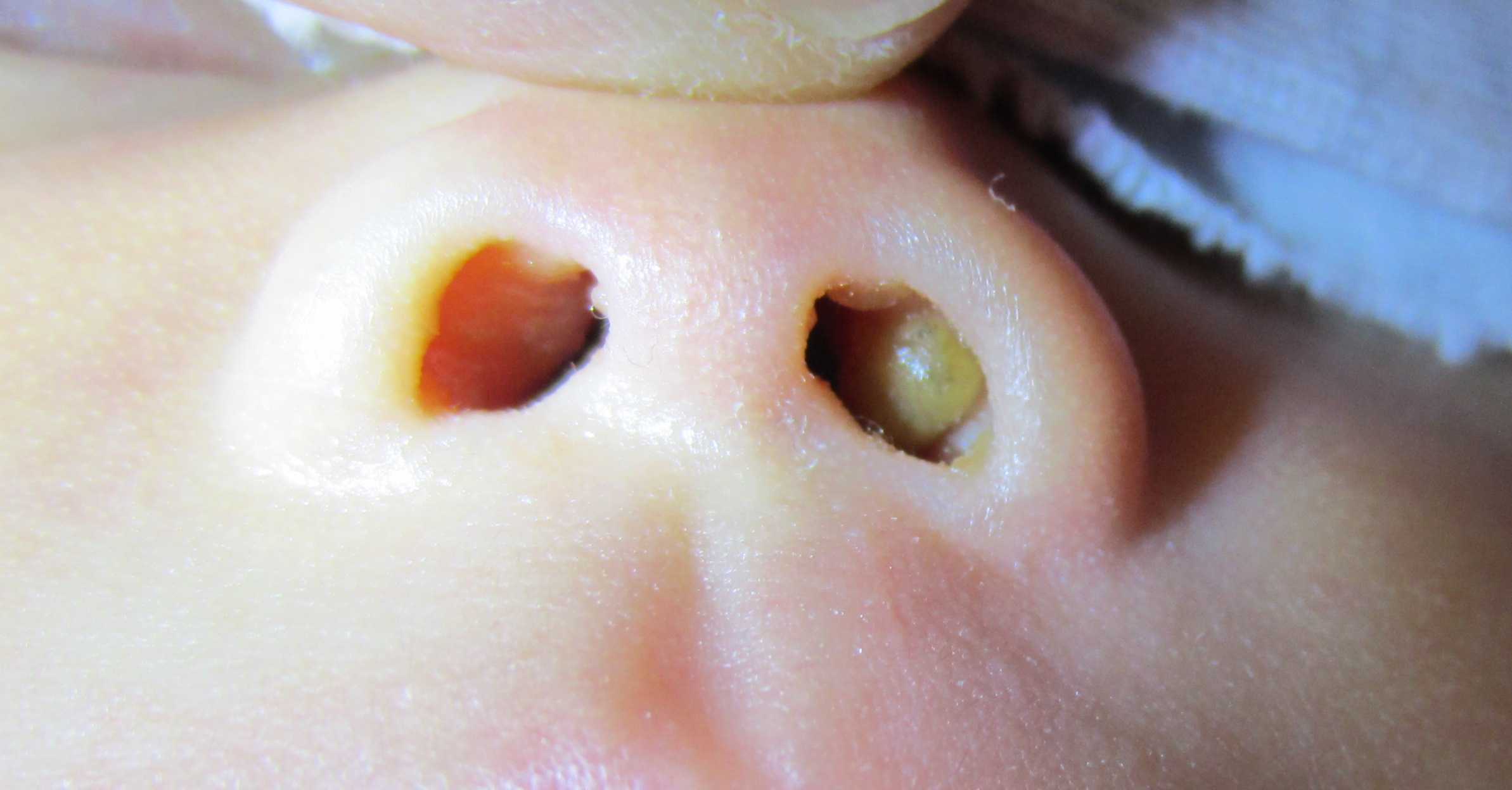 借卵咨询套餐,饭后心跳快心慌胸闷是怎么回事